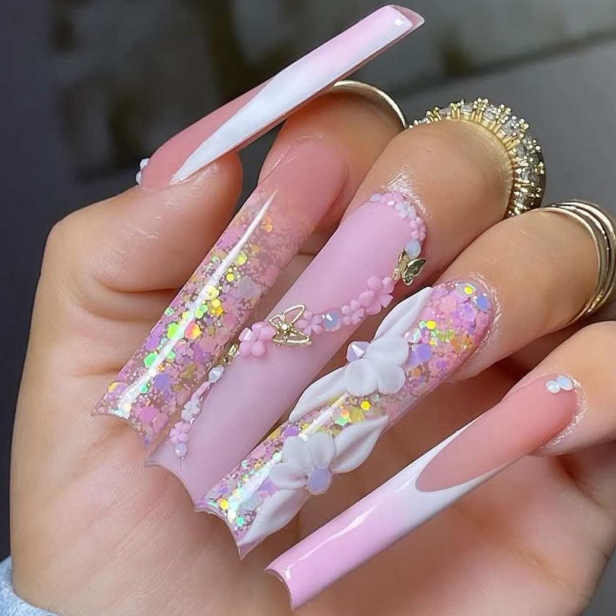 Enhancements